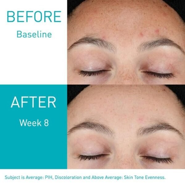 Cerave Resurfacing Retinol Serum 30 ml - Image 3